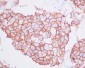 Anti-ErbB2 (HER2) Monoclonal Antibody